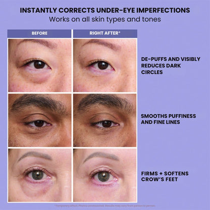 InstantLift+ Eye Tightener