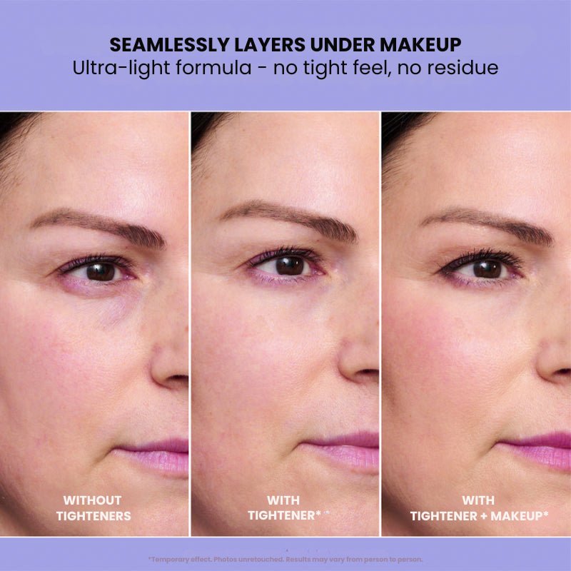 InstantLift+ Eye Tightener